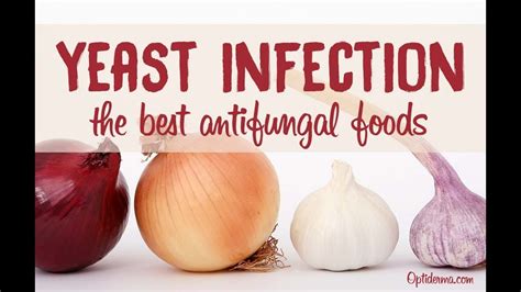 YEAST INFECTION O IMPEKSIYON SA ARI NG BABAE: ANO .